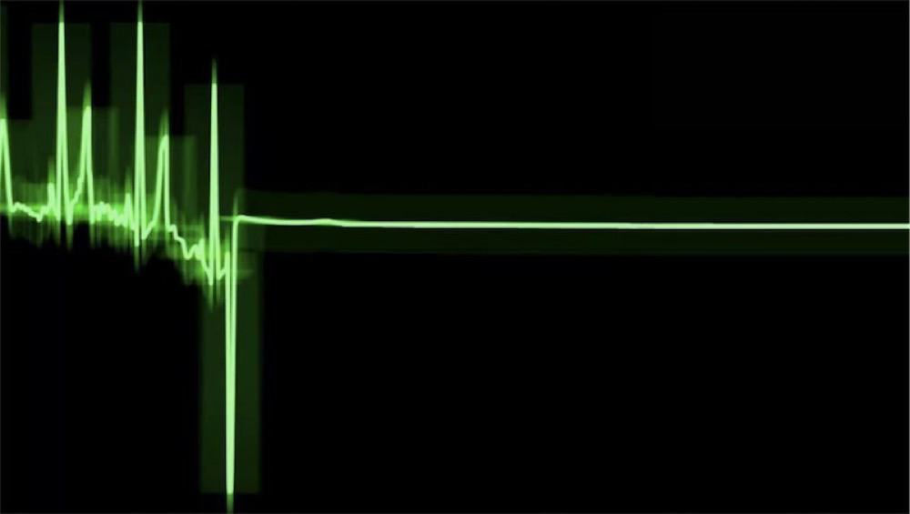 Brain Activity Recorded Ten Minutes After Cardiac Arrest