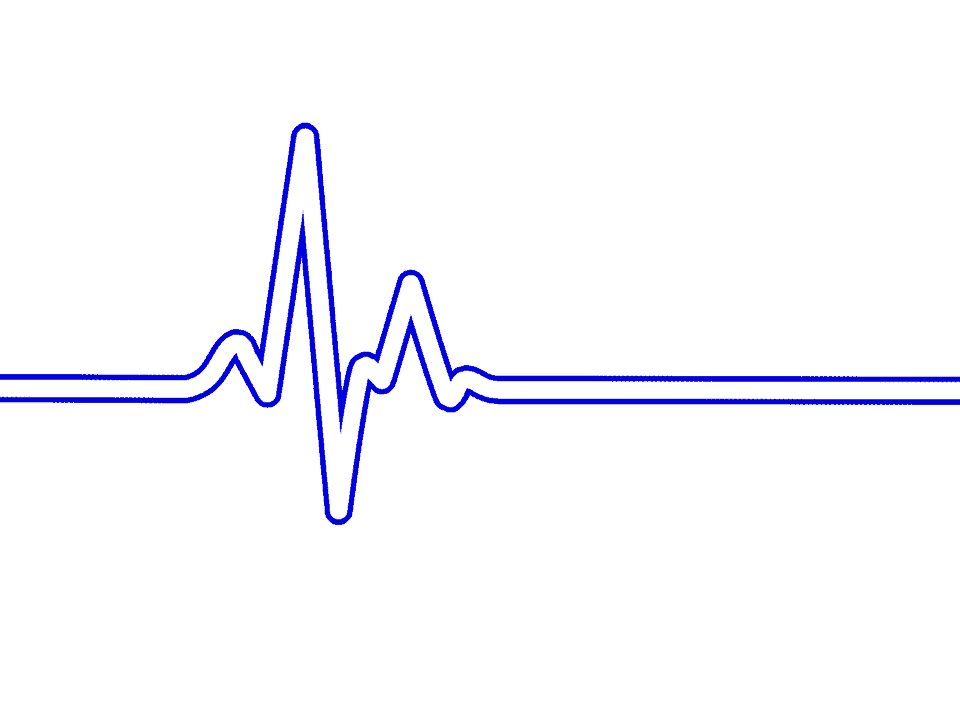 Heart rhythm and frequency illustration